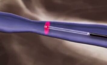 Tratamientos termales