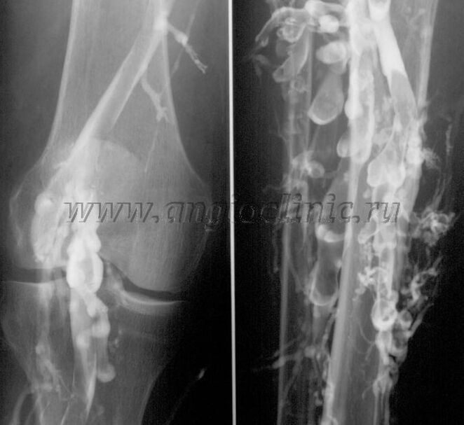 examen de ultrasonido